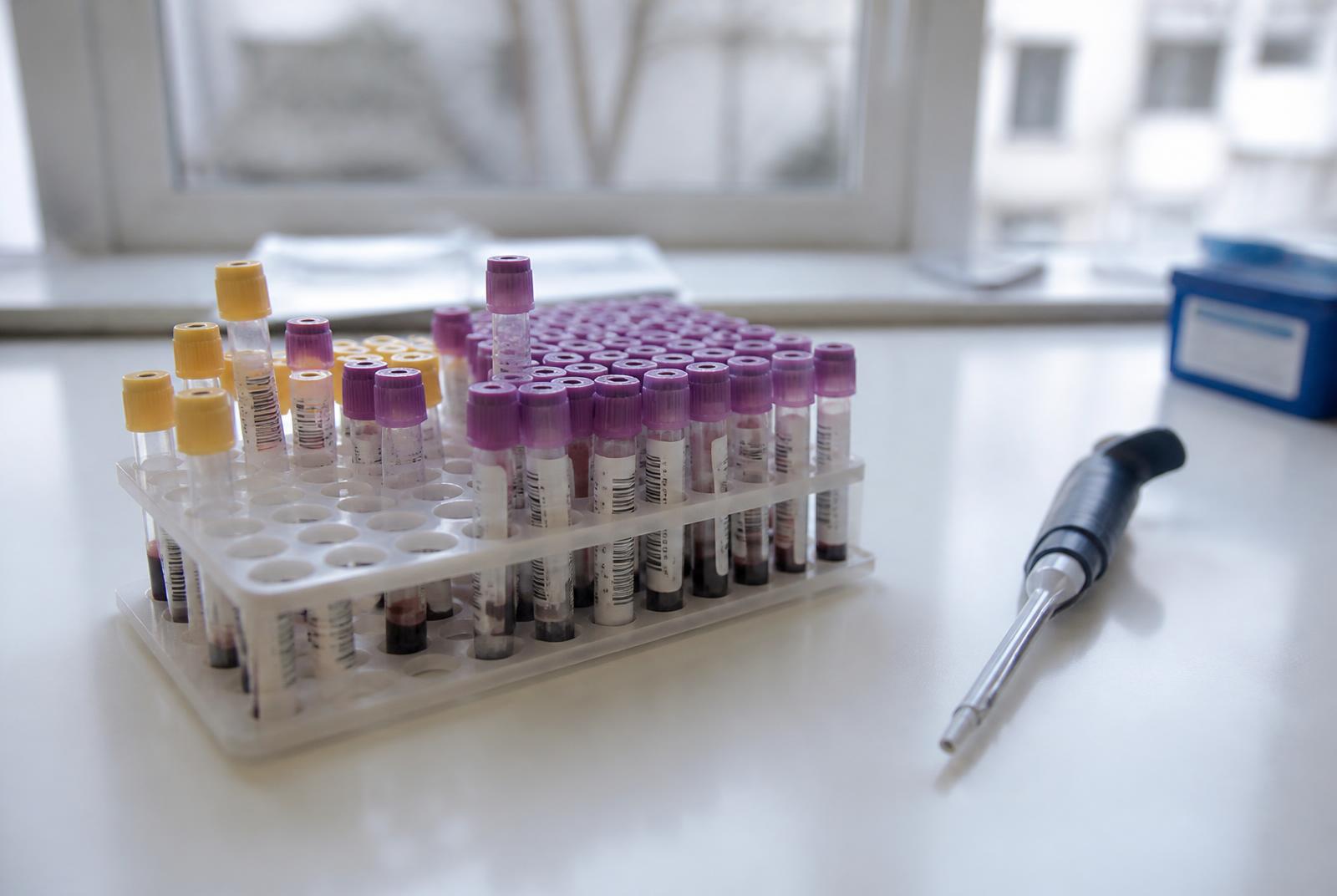 Vereproovide alused laboris — metaboolse paketi analüüsid tehakse Synlabis.